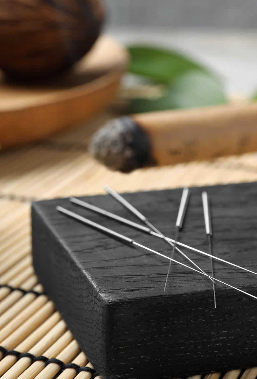 acupuncture needles